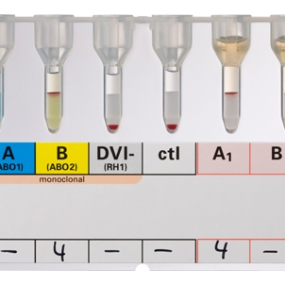 ID Gel Card System